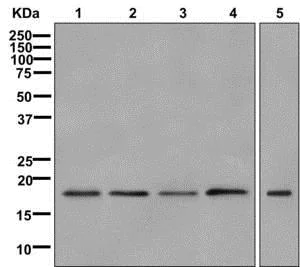 Western blot - Anti-SAP18 antibody [EPR12956(B)] (AB175920)