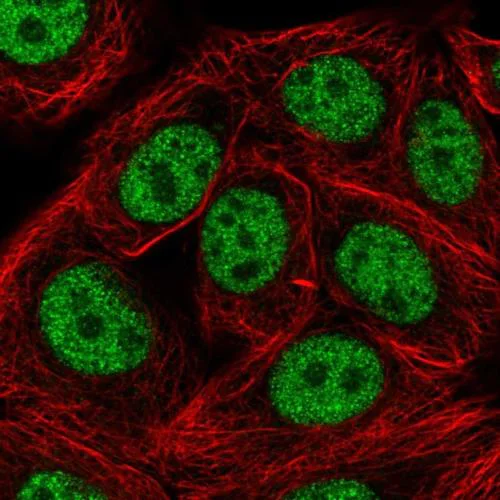 Immunocytochemistry/ Immunofluorescence - Anti-SAP30BP antibody (AB204320)