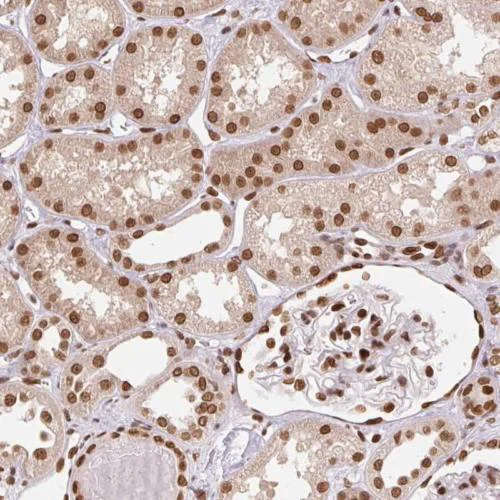 Immunohistochemistry (Formalin/PFA-fixed paraffin-embedded sections) - Anti-SAP30BP antibody (AB204320)