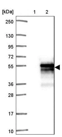 Western blot - Anti-SAP30BP antibody (AB204320)
