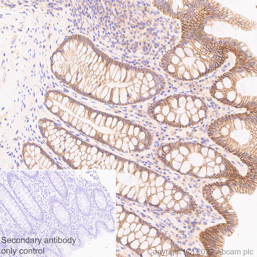 Immunohistochemistry (Formalin/PFA-fixed paraffin-embedded sections) - Anti-SAP97 antibody [EPR26467-123] (ab300481), expandable thumbnail