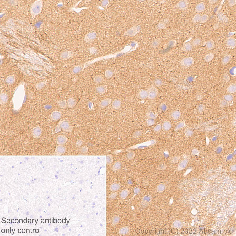 Immunohistochemistry (Formalin/PFA-fixed paraffin-embedded sections) - Anti-SAP97 antibody [EPR26467-123] (AB300481), expandable thumbnail