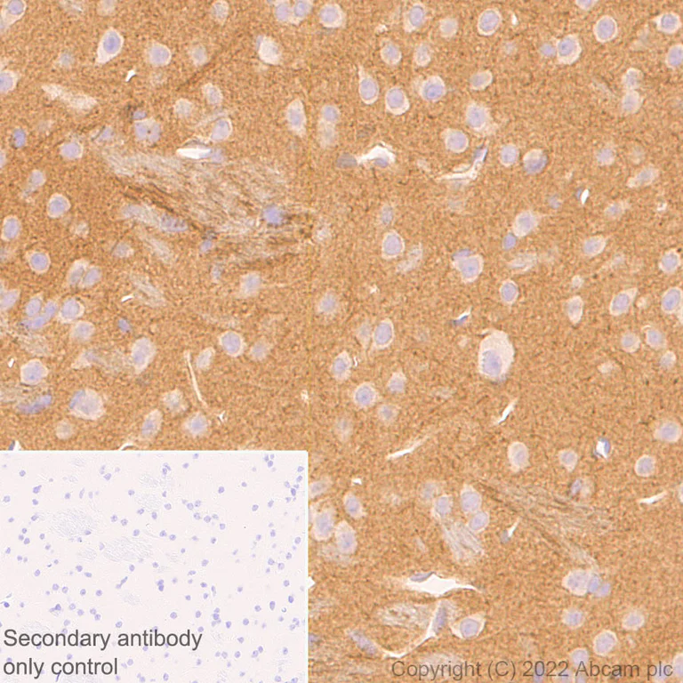 Immunohistochemistry (Formalin/PFA-fixed paraffin-embedded sections) - Anti-SAP97 antibody [EPR26467-123] (BSA and Azide free) (AB300482)
