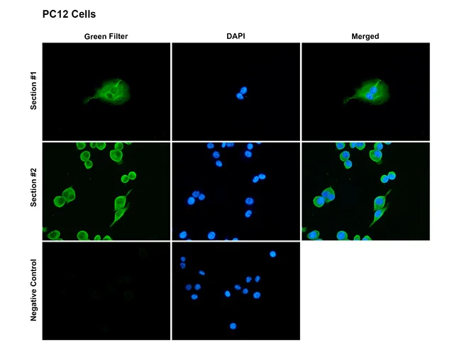 Immunocytochemistry/ Immunofluorescence - Anti-SAP97 antibody [G28] (AB326352)