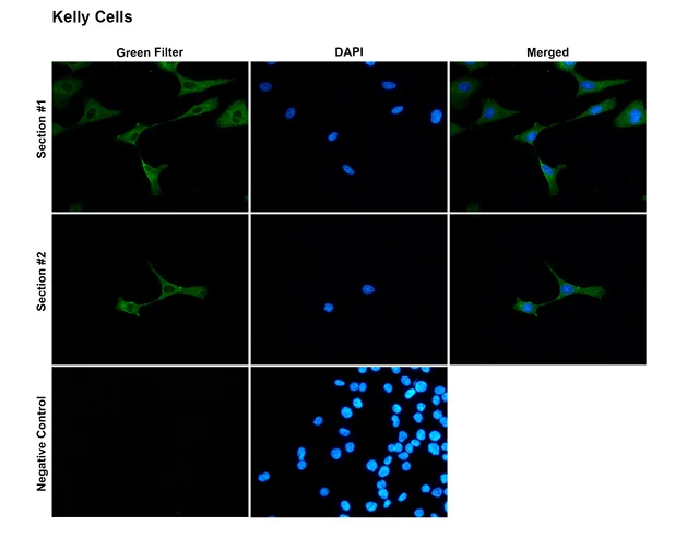 Immunocytochemistry/ Immunofluorescence - Anti-SAP97 antibody [G28] (AB326352)