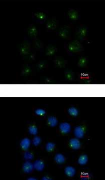 Immunocytochemistry/ Immunofluorescence - Anti-SAR1 antibody (AB125871), expandable thumbnail