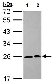 Western blot - Anti-SAR1 antibody (AB125871), expandable thumbnail