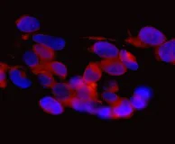 Immunocytochemistry/ Immunofluorescence - Anti-SAR1B + SAR1A antibody [EPR10105(B)] (AB155278)