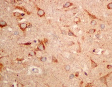 Anti-SAR1B + SAR1A antibody [EPR10105(B)]
