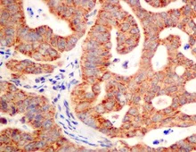 Immunohistochemistry (Formalin/PFA-fixed paraffin-embedded sections) - Anti-SAR1B + SAR1A antibody [EPR10105(B)] - BSA and Azide free (AB249196)