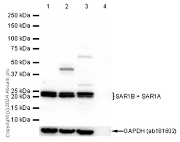 Western blot - Anti-SAR1B + SAR1A antibody [EPR10105(B)] - BSA and Azide free (AB249196)