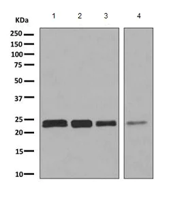 Western blot - Anti-SAR1B + SAR1A antibody [EPR10105(B)] - BSA and Azide free (AB249196)