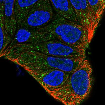 Immunocytochemistry/ Immunofluorescence - Anti-SARA antibody (AB221488)