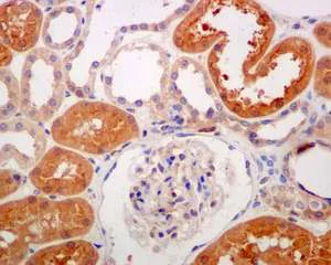 Immunohistochemistry (Formalin/PFA-fixed paraffin-embedded sections) - Anti-SARA antibody [EPR5020] (AB124875)