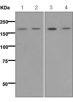 Western blot - Anti-SARA antibody [EPR5020] - BSA and Azide free (AB248032)