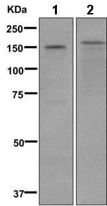 Western blot - Anti-Sarcalumenin antibody [EPR12590] (AB173294)