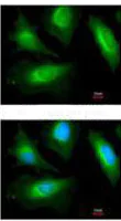 Immunocytochemistry/ Immunofluorescence - Anti-Sarcomeric Alpha Actinin antibody (AB113086)