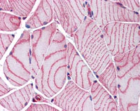 Immunohistochemistry (Formalin/PFA-fixed paraffin-embedded sections) - Anti-Sarcomeric Alpha Actinin antibody (AB113086)