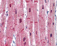 Immunohistochemistry (Formalin/PFA-fixed paraffin-embedded sections) - Anti-Sarcomeric Alpha Actinin antibody (AB113086)