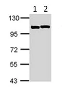 Western blot - Anti-Sarcomeric Alpha Actinin antibody (AB113086)