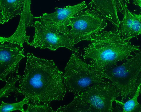 Immunocytochemistry/ Immunofluorescence - Anti-Sarcomeric Alpha Actinin antibody (AB137346)