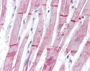Immunohistochemistry (Formalin/PFA-fixed paraffin-embedded sections) - Anti-Sarcomeric Alpha Actinin antibody (AB137346), expandable thumbnail