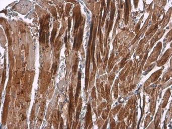 Immunohistochemistry (Formalin/PFA-fixed paraffin-embedded sections) - Anti-Sarcomeric Alpha Actinin antibody (ab137346), expandable thumbnail