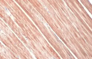 Immunohistochemistry (Formalin/PFA-fixed paraffin-embedded sections) - Anti-Sarcomeric Alpha Actinin antibody (AB137346)