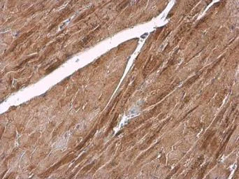 Immunohistochemistry (Formalin/PFA-fixed paraffin-embedded sections) - Anti-Sarcomeric Alpha Actinin antibody (AB137346)