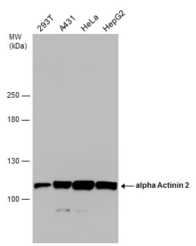 Western blot - Anti-Sarcomeric Alpha Actinin antibody (AB137346), expandable thumbnail