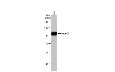 Western blot - Anti-Sarcomeric Alpha Actinin antibody (AB137346)