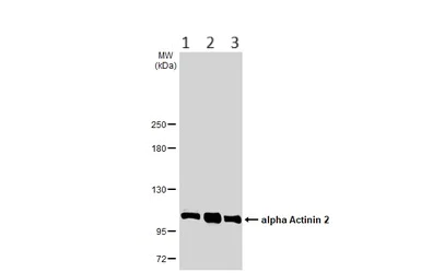Western blot - Anti-Sarcomeric Alpha Actinin antibody (AB137346)