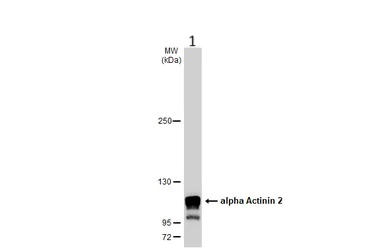 Western blot - Anti-Sarcomeric Alpha Actinin antibody (AB137346)