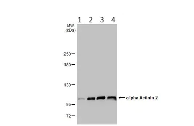 Western blot - Anti-Sarcomeric Alpha Actinin antibody (AB137346)