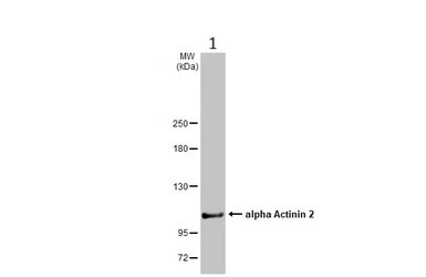 Anti-Sarcomeric Alpha Actinin antibody