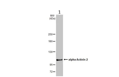 Western blot - Anti-Sarcomeric Alpha Actinin antibody (AB137346)