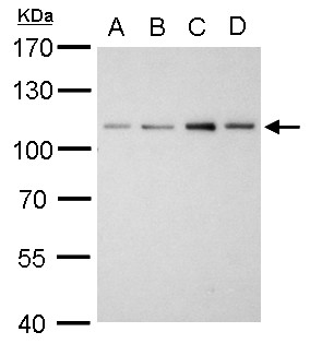 Western blot - Anti-Sarcomeric Alpha Actinin antibody (AB137346), expandable thumbnail
