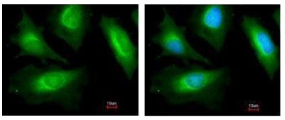 Immunocytochemistry/ Immunofluorescence - Anti-Sarcomeric Alpha Actinin antibody (AB227216)