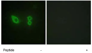 Immunocytochemistry/ Immunofluorescence - Anti-Sarcomeric Alpha Actinin antibody (AB72592)