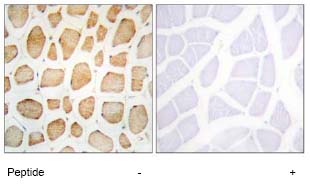 Immunohistochemistry (Formalin/PFA-fixed paraffin-embedded sections) - Anti-Sarcomeric Alpha Actinin antibody (AB72592)