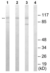 Western blot - Anti-Sarcomeric Alpha Actinin antibody (AB72592)