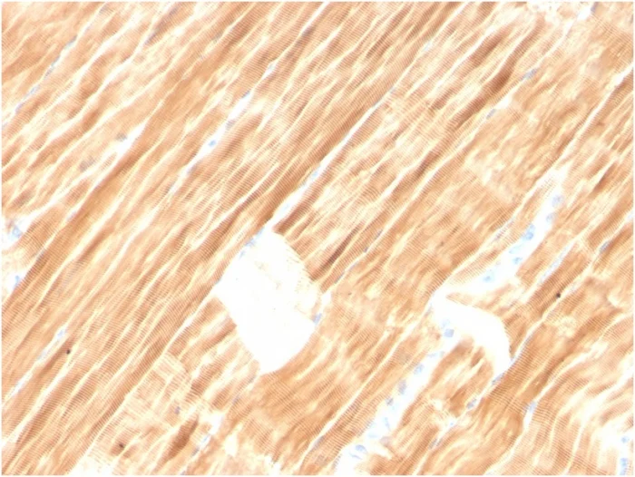 Immunohistochemistry (Formalin/PFA-fixed paraffin-embedded sections) - Anti-Sarcomeric Alpha Actinin antibody [ACTN2/3292] (AB257317)