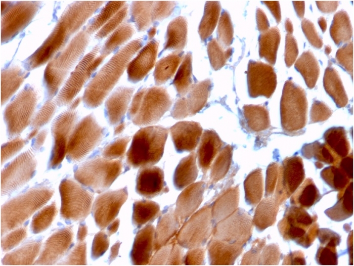 Immunohistochemistry (Formalin/PFA-fixed paraffin-embedded sections) - Anti-Sarcomeric Alpha Actinin antibody [ACTN2/3292] (AB257317)