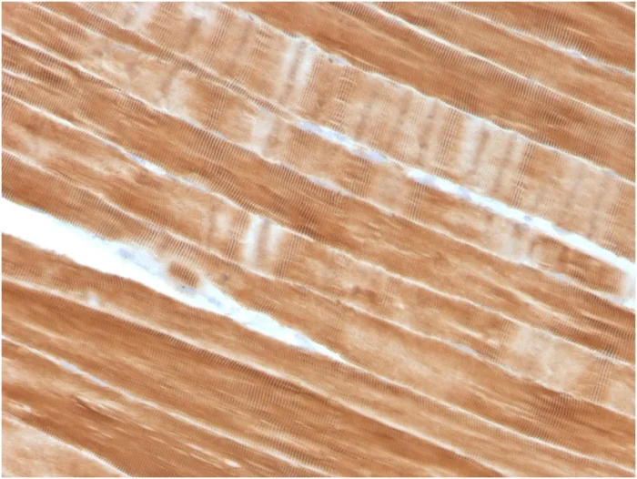 Immunohistochemistry (Formalin/PFA-fixed paraffin-embedded sections) - Anti-Sarcomeric Alpha Actinin antibody [ACTN2/3292] (AB257317)