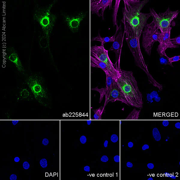 Immunocytochemistry/ Immunofluorescence - Anti-Sarcomeric Alpha Actinin antibody [EA-53] (AB9465)