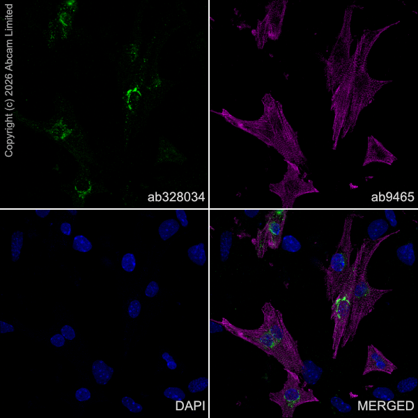 Anti-sarcomeric alpha-actinin antibody [EA-53] (ab9465) | Abcam