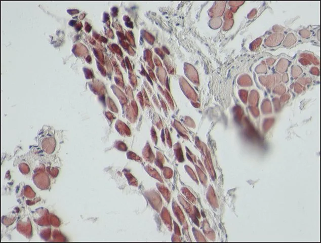 Immunohistochemistry (Formalin/PFA-fixed paraffin-embedded sections) - Anti-Sarcomeric Alpha Actinin antibody [EA-53] (AB9465)