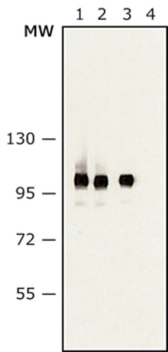 Western blot - Anti-Sarcomeric Alpha Actinin antibody [EA-53] (AB9465)