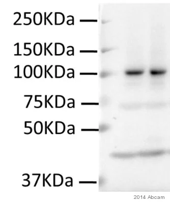 Western blot - Anti-Sarcomeric Alpha Actinin antibody [EA-53] (AB9465)