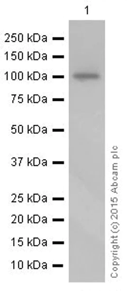 Western blot - Anti-Sarcomeric Alpha Actinin antibody [EP2529Y] (AB68167)